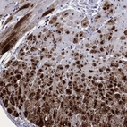 Immunohistochemical staining of human heart muscle shows high expression.