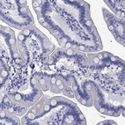 Immunohistochemical staining of human duodenum shows low expression as expected.