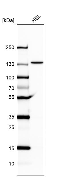 Anti-UBE4A Antibody