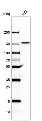 Anti-UBE4A Antibody