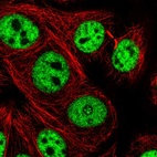 Immunofluorescent staining of human cell line MCF7 shows localization to nuclear speckles & nucleoli fibrillar center.