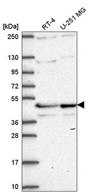 Anti-TMEM5 Antibody