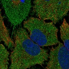 Anti-TMCO5A Antibody