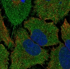 Anti-TMCO5A Antibody