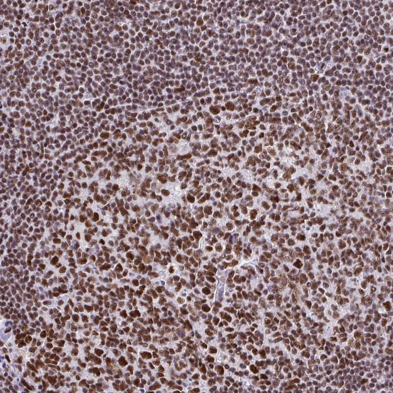 Anti-TRIM28 Antibody