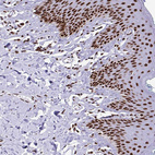Immunohistochemical staining of human skin shows strong nuclear positivity in squamous epithelial cells.