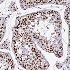 Immunohistochemical staining of human testis shows strong nuclear positivity in cells in seminiferous ducts and leydig cells.