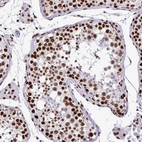 Immunohistochemical staining of human testis shows strong nuclear positivity in cells in seminiferous ducts and leydig cells.