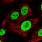 Immunofluorescent staining of human cell line A549 shows localization to nucleoplasm.