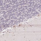 Anti-KDM4D Antibody