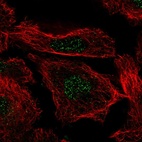 Anti-H3-3B Antibody