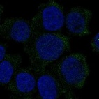Anti-HBZ Antibody