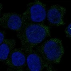 Anti-HBZ Antibody