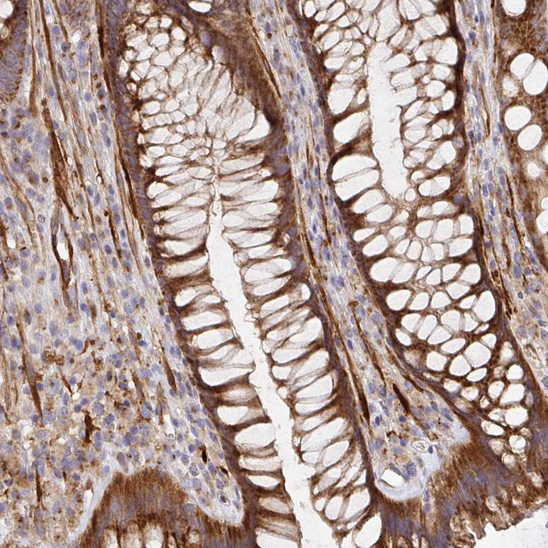 Anti-TM9SF4 Antibody