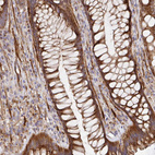 Anti-TM9SF4 Antibody
