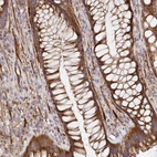Anti-TM9SF4 Antibody