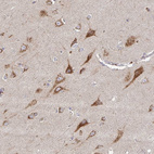 Immunohistochemical staining of human cerebral cortex shows strong cytoplasmic granular positivity in neurons.