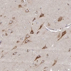 Immunohistochemical staining of human cerebral cortex shows strong cytoplasmic granular positivity in neurons.