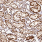Immunohistochemical staining of human kidney shows strong cytoplasmic granular positivity in cells in tubules.