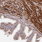 Immunohistochemical staining of human prostate shows strong cytoplasmic granular positivity in smooth muscle cells and glandular cells.