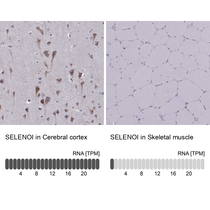 Anti-SELENOI Antibody