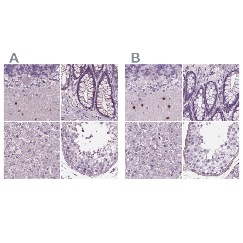 Anti-BHLHE22 Antibody