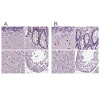 Anti-BHLHE22 Antibody