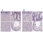 Anti-BHLHE22 Antibody