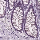 Immunohistochemical staining of human colon using Anti-BHLHE22 antibody HPA064128.