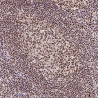 Anti-SNRPG Antibody