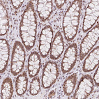 Immunohistochemical staining of human rectum shows strong nuclear positivity in glandular cells.