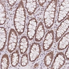 Immunohistochemical staining of human rectum shows strong nuclear positivity in glandular cells.