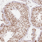 Immunohistochemical staining of human testis shows strong nuclear positivity in cells in seminiferous ducts.