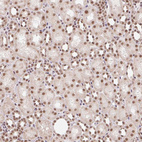 Immunohistochemical staining of human kidney shows strong nuclear positivity in cells in tubules.