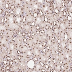 Immunohistochemical staining of human kidney shows strong nuclear positivity in cells in tubules.