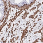 Immunohistochemical staining of human prostate shows strong membranous positivity in smooth muscle cells.