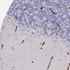 Immunohistochemical staining of human cerebellum shows no positivity in Purkinje cells only in endothelial cells as expected.