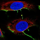 Immunofluorescent staining of human cell line U-2 OS shows localization to plasma membrane & vesicles.