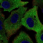 Immunofluorescent staining of human cell line A549 shows localization to cytosol & vesicles.