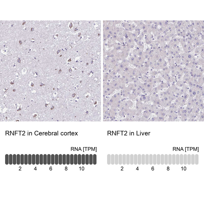 Anti-RNFT2 Antibody