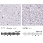Anti-RNFT2 Antibody