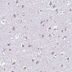 Immunohistochemical staining of human cerebral cortex shows high expression.