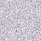 Immunohistochemical staining of human liver shows low expression as expected.