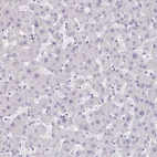 Immunohistochemical staining of human liver shows low expression as expected.