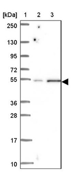 Lane 1: Marker [kDa] 250, 130, 95, 72, 55, 36, 28, 17, 10_br/_Lane 2: Human cell line RT-4_br/_Lane 3: Human cell line U-251MG sp