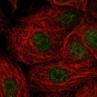 Immunofluorescent staining of human cell line MCF7 shows localization to nucleoplasm.