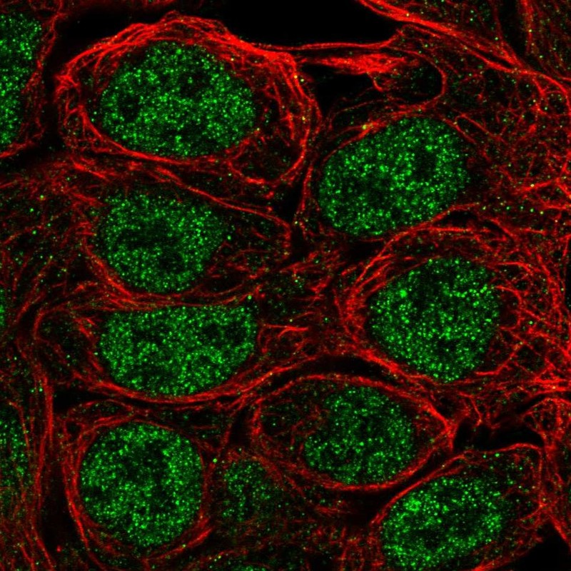 Anti-S100A5 Antibody