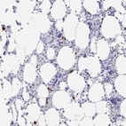 Immunohistochemical staining of human bone marrow shows high expression.