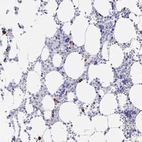 Immunohistochemical staining of human bone marrow shows high expression.