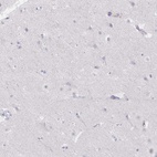 Immunohistochemical staining of human cerebral cortex shows low expression as expected.